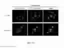 Fig. 09 - Compositions and methods for using albumin-based nanomedicines