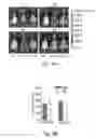 Fig. 11 - Methods for treating subjects suffering from acute myeloid leukemia with FLT3 ligand-targeted miR-150 nanoparticles