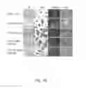Fig. 32 - Methods for treating subjects suffering from acute myeloid leukemia with FLT3 ligand-targeted miR-150 nanoparticles