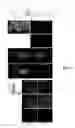 Fig. 07 - Methods and systems for noninvasive control of brain cells and related vectors and compositions