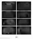 Fig. 08 - Methods and systems for noninvasive control of brain cells and related vectors and compositions
