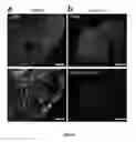 Fig. 09 - Methods and systems for noninvasive control of brain cells and related vectors and compositions