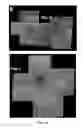 Fig. 03 - Methods for treating and diagnosing blinding eye diseases