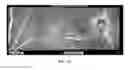 Fig. 04 - Methods for treating and diagnosing blinding eye diseases
