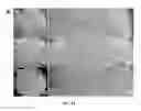 Fig. 09 - Methods for treating and diagnosing blinding eye diseases