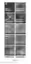 Fig. 16 - Methods for treating and diagnosing blinding eye diseases