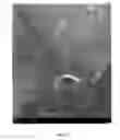 Fig. 19 - Methods for treating and diagnosing blinding eye diseases