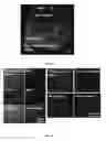 Fig. 25 - Methods for treating and diagnosing blinding eye diseases