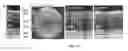 Fig. 30 - Methods for treating and diagnosing blinding eye diseases