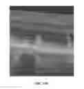Fig. 33 - Methods for treating and diagnosing blinding eye diseases