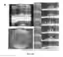 Fig. 34 - Methods for treating and diagnosing blinding eye diseases