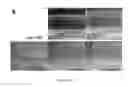 Fig. 35 - Methods for treating and diagnosing blinding eye diseases