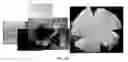 Fig. 37 - Methods for treating and diagnosing blinding eye diseases