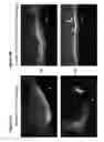 Fig. 03 - Reparative cell isolation and delivery