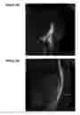 Fig. 04 - Reparative cell isolation and delivery