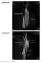 Fig. 06 - Reparative cell isolation and delivery
