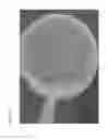 Fig. 06 - Methods and polymer compositions for treating retinal detachment and other ocular disorders