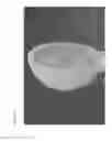 Fig. 07 - Methods and polymer compositions for treating retinal detachment and other ocular disorders
