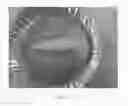 Fig. 05 - Implants having a drug load of an oxysterol and methods of use