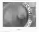 Fig. 06 - Implants having a drug load of an oxysterol and methods of use