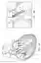 Fig. 02 - Ventricular assist device