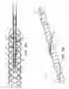 Fig. 08 - Ventricular assist device