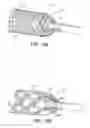 Fig. 09 - Ventricular assist device