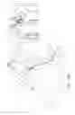 Fig. 10 - Ventricular assist device