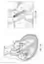 Fig. 02 - Ventricular assist device