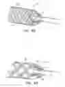 Fig. 09 - Ventricular assist device