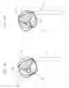 Fig. 08 - Impeller for use in blood pump