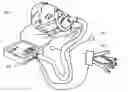 Fig. 01 - DEVICES AND METHODS FOR NON-INVASIVE CARDIO-ADAPTIVE POSITIVE PRESSURE VENTILATION THERAPY