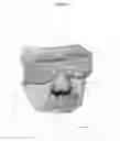 Fig. 03 - SEAL-FORMING STRUCTURE FOR TREATING SLEEP DISORDERED BREATHING