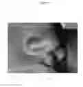 Fig. 08 - SEAL-FORMING STRUCTURE FOR TREATING SLEEP DISORDERED BREATHING