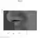 Fig. 09 - SEAL-FORMING STRUCTURE FOR TREATING SLEEP DISORDERED BREATHING