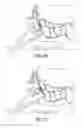 Fig. 08 - Sinus balloon dilation catheters and sinus surgery tools
