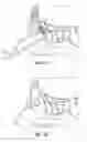 Fig. 09 - Sinus balloon dilation catheters and sinus surgery tools