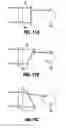Fig. 07 - Extractor for removing a lead from a patient