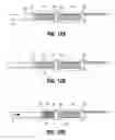 Fig. 08 - Extractor for removing a lead from a patient
