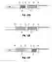 Fig. 09 - Extractor for removing a lead from a patient