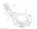 Fig. 01 - Methods and apparatus to inactivate infectious agents on a drainage catheter residing in a body cavity