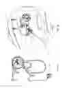 Fig. 07 - Isokinetic rope climbing method and machine