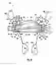 Fig. 04 - ANCHORED RESISTANCE EXERCISE DEVICE WITH SENSOR