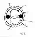 Fig. 08 - SQUASH BALL LAUNCHING MACHINE