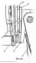 Fig. 08 - Training device for ball sports