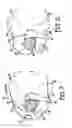 Fig. 04 - Batting pad for adjusting location of bat in batter's hand