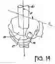 Fig. 08 - Batting pad for adjusting location of bat in batter's hand