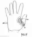 Fig. 10 - Batting pad for adjusting location of bat in batter's hand