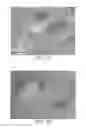 Fig. 02 - METHODS OF MAKING HIGHLY PURIFIED DIATOMACEOUS EARTH WITH WIDE RANGE OF FILTRATION RATES