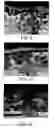 Fig. 06 - Catalytic coatings, methods of making and use thereof